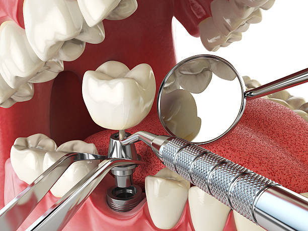 Best Pediatric Emergency Dentist in Santa Ana, CA